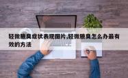 轻微腋臭症状表现图片,轻微腋臭怎么办最有效的方法
