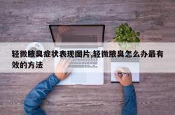 轻微腋臭症状表现图片,轻微腋臭怎么办最有效的方法