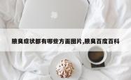 腋臭症状都有哪些方面图片,腋臭百度百科